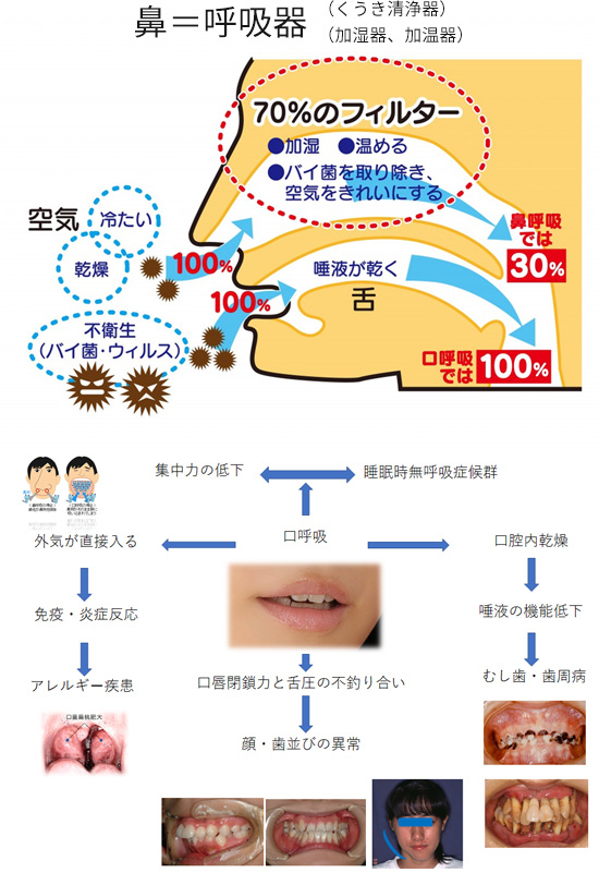 口呼吸について